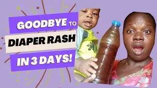 How to Get Rid of Diaper Rash FAST!  Simple Tips Every Parent Should Know