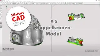SilaPart CAD Tutorialreihe - #5 - Doppelkronen-Modul