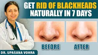 Skin Transformation Challenge | Remove Blackhead Naturally in 7 Days💕 | Upasana Ki Duniya