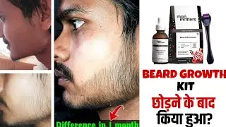 Man matters beard growth kit छोड़ने के बाद दाढ़ी फिर से चला गया | minoxidil beard growth |