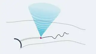 Echotherapy   how it works for varicose veins