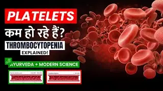 Are platelets decreasing? | Thrombocytopenia Explained | Ayurvedic + Modern Treatment