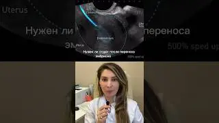Нужен ли отдых после переноса эмбриона в ЭКО или можно сразу вставать?