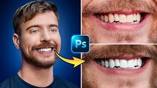 How To Whiten Teeth Like Mr Beast! 🦷✨