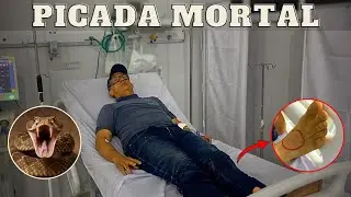 TODO CUIDADO &Eacute; POUCO | JAVALI BRASIL
