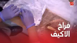 طريقة تحضير تشيكن الاكيف مع الشيف حسن