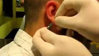 5mm tunnel at once