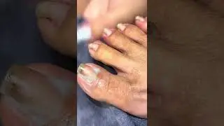 CRAZY Thick Cuticles Removal! 🤯 ep1 #amazing #cleaningenthusiast #nails #trending #viralvideo 