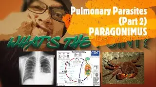 PULMONARY PARASITES (Part 2 of 3) - PARAGONIMUS