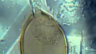 Test/Microscope Whipworm Egg