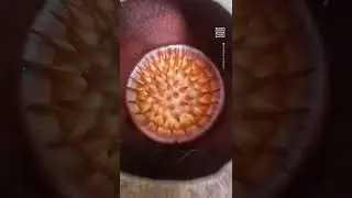 Man Finds Rare & Largest Flower in the World in Indonesia