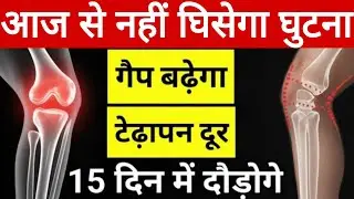 घुटनों के दर्द से छुटकारा पाए | Ghutnokedard ka illaj | Knee pain |Just Do these5 Exercise