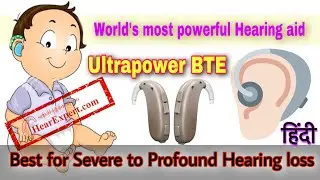 World's most powerful Hearing aid for Severe to Profound Hearing loss | Oticon Xceed Ultrapower BTE|