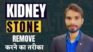 Kidney stone remove karneka tarika. by Nt Amit Kumar.