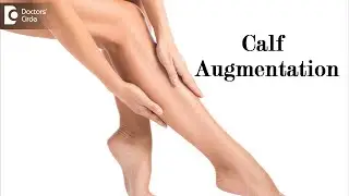 Calf Augmentation | Indication, Procedure & Recovery | SKINNY LEG- Dr. Srikanth. V | Doctors' Circle