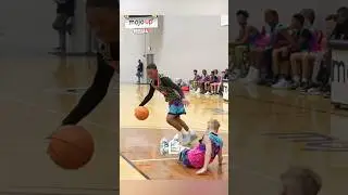 He BROKE His Ankles 4 TIMES In ONE Game 😱
