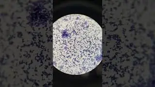 #Grams_staining 🔬Enterococcus_faecalis🦠#Microscopy🔬 #Gram_positive_cocci in pairs🟣🟣#Microbiology_lab