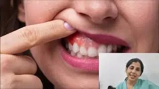 common dental problems in pregnancy . #PregnancyDental