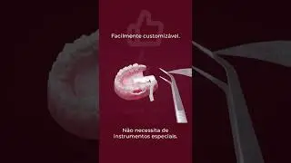 Aplica&ccedil;&atilde;o das barreiras Bone Heal&reg; e Heal Bone&reg;