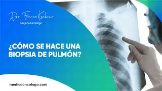 &iquest;C&oacute;mo Se Hace Una Biopsia De Pulm&oacute;n? | Dr. Franco Krakaur | Cirujano Onc&oacute;logo