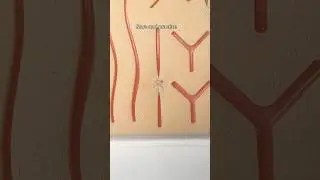 X suture made easy ✨    #medicine #surgeon #surgicalskills #suturing #suture