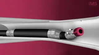 IMS Robotic Cutter - rebar