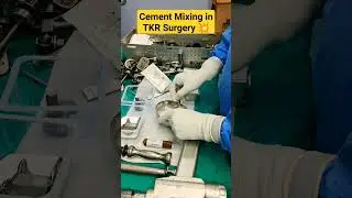 Cement Mixing Process For Total Knee Replacement 💥#totalkneereplacementsurgery #replacement #knee