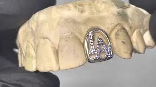 Single Tooth Open Face Grillz w Blue Sapphire LA Dodgers Logo (14K White Gold) | Luxe Grillz
