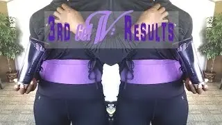 My 3rd Gel-V Results (BEAUTYCUTRIGHT)