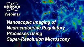 Cellular Revelations in the Brain with Super-Resolution Microscopy | Bruker Webinar