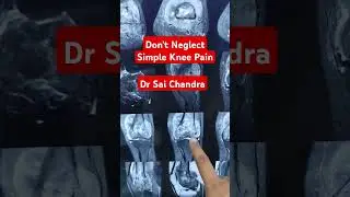 Don't Neglect Simple Knee Pain.. Dr Sai Chandra MBBS DNB Ortho