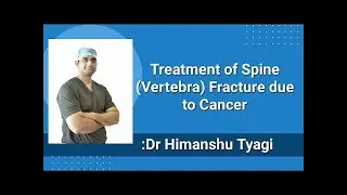 Treatment of Spine vertebral fracture due to cancer (metastatic)