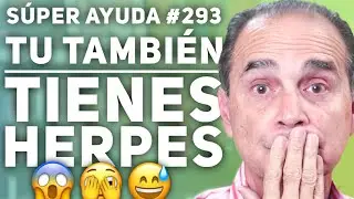 S&Uacute;PER AYUDA #293 Tu Tambi&eacute;n Tienes Herpes