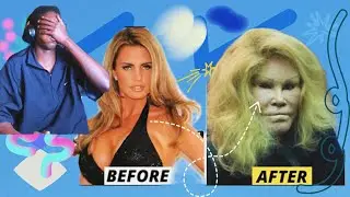 Top 20 Celebrity Plastic Surgery Disasters: Extreme Transformations and What We Can Learn