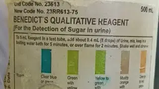 urine में sugar देखने का method 💬🤔 #mltkalaamkhan #laboratorywork