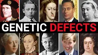 15 British Royals Born With SHOCKING Physical Abnormalities | For Sleep