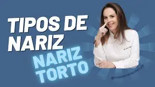 Nariz torto