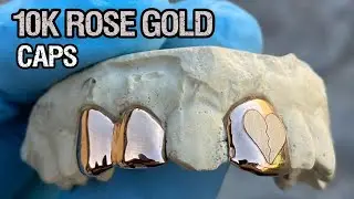 10K Rose Gold Broken Heart Laser Engraved Tooth Single with Double Cap Custom Grillz