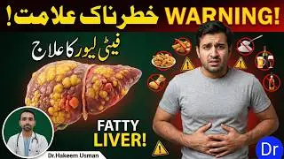 Fatty Liver Causes, Signs & Natural Prevention Tips | Healthy Tips | dr.Hakeem Usman