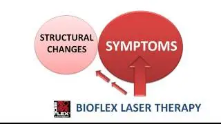 Bioflex Cold Laser for Arthritis pain