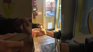 Thumb Spica Tape Job