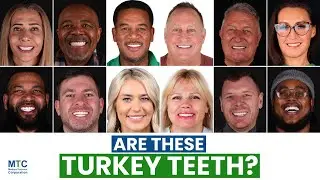 Cosmetic Dentistry in Istanbul: How To Get a Hollywood Smile in Turkey!