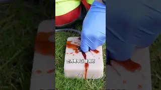 손가락을 쑤셔야 하는 이유