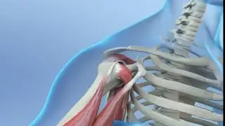 ‼️‼️No More Shoulder Pain/Rotator cuff repair‼️‼️