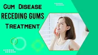 Receding Gums - Best Gum Disease Receding Gums Treatment Natural