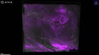 3D prostate tissue imaging reveals collagen architecture