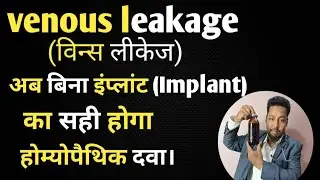 Venous leakage best homeopathic medicine 