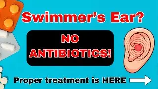 ENT doctor explains proper evidence-based treatment for Swimmer&rsquo;s ear (acute otitis externa).
