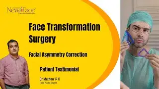 Face Transformation Surgery in India -Patient Testimonial |Free Online Consultation - +91 8330077198