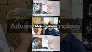 Full Jaw Restoration | All-on-X with Advanced Digital Dentistry #dentist #shorts #foryou #short